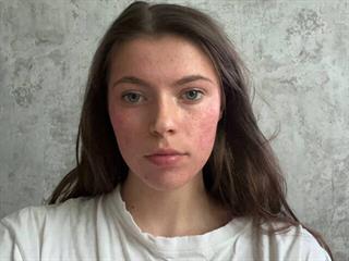 Jackelyn Garhart
