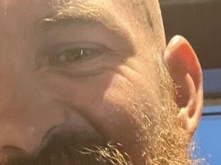 32XRedBeard