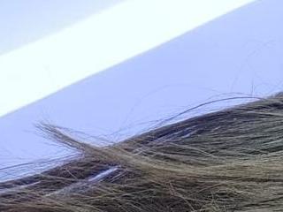 Alisson 5 