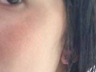 Aome 01