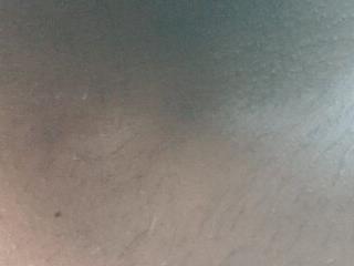 FinableKnee