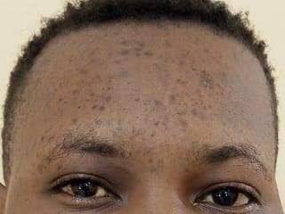 Fleshydarkass