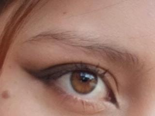 Fox freckles